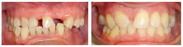 RTHODONTIC TREATMENT IN CONJUNCTION WITH OTHER DISCIPLINES OF DENTISTRY